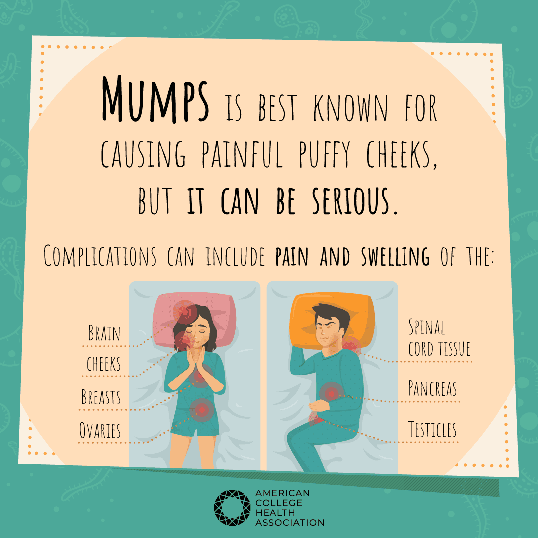 Mumps-Social-media-posts_1